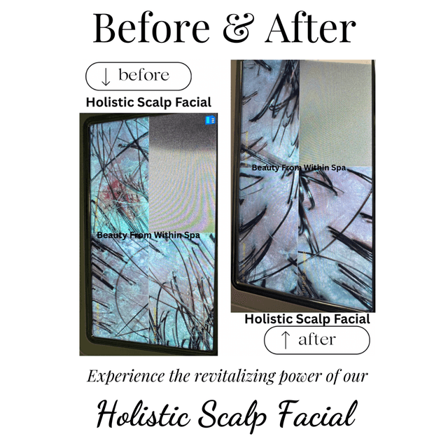 Scalp Restoration (3)