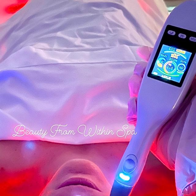 Jet Plasma Facial ( 3 treatments)